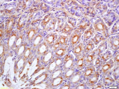 磷酸化肝细胞生长因子受体(原癌基因)抗体