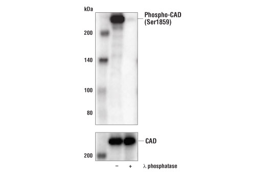 Phospho-CAD (Ser1859) (D5K5W) Rabbit mAb