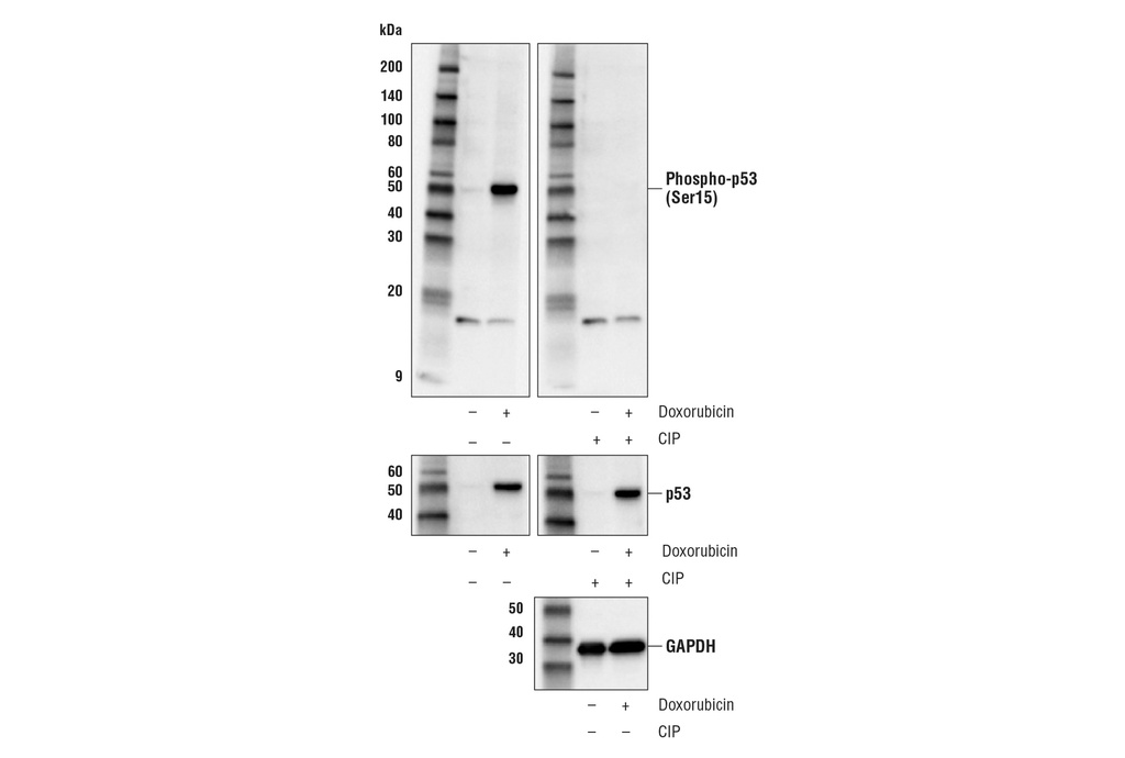 Phospho-p53 (Ser15) (E9Y4U) Rabbit mAb