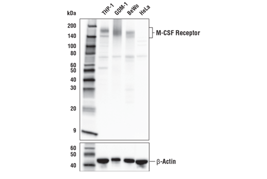 Suppressive Myeloid Cell Phenotyping IHC Antibody Sampler Kit