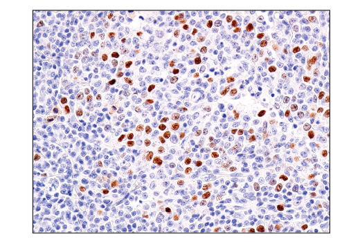 BCL6 (E5I8I) Rabbit mAb