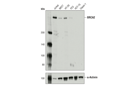 Homologous Recombination (HR) DNA Repair Antibody Sampler Kit