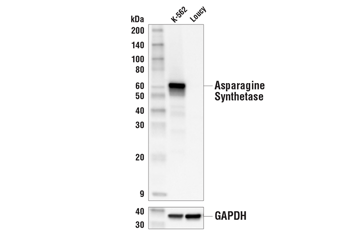 Asparagine Synthetase (E6C2C) XP Rabbit mAb