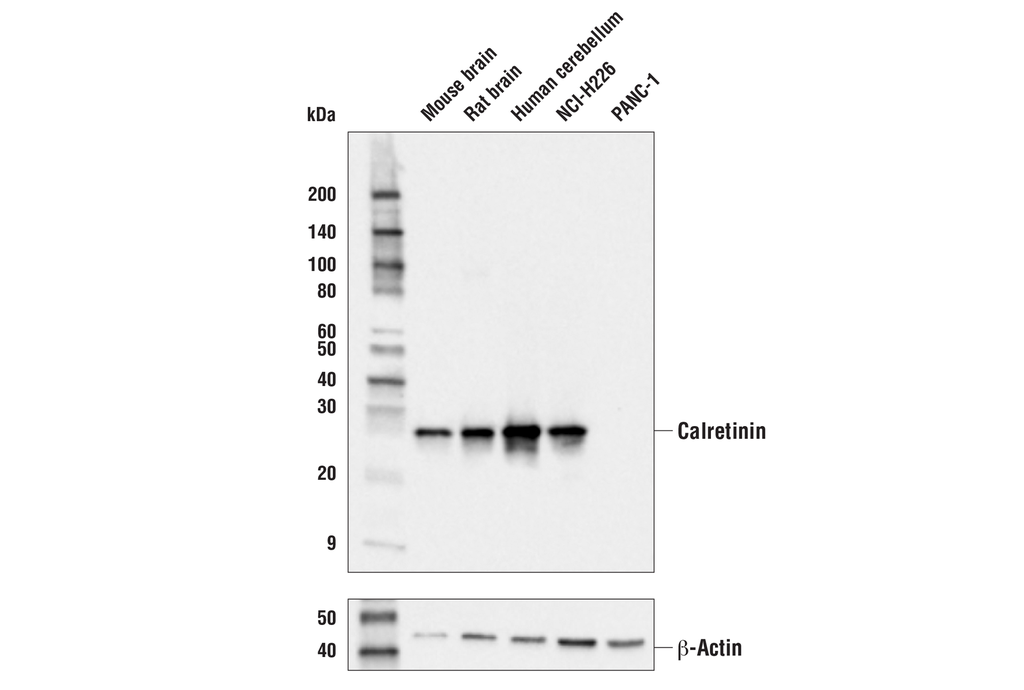 Calretinin (E7R6O) XP Rabbit mAb