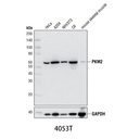 PKM2 (D78A4) XP Rabbit mAb