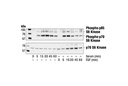 Phospho-p70 S6 Kinase (Thr421/Ser424) Antibody