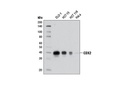 CDX2 (D11D10) Rabbit mAb