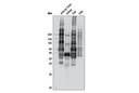 Phospho-(Ser/Thr) Kinase Substrate Antibody Sampler Kit