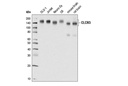CLCN3 (D8Y5Q) Rabbit mAb