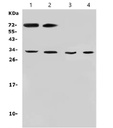 Anti-Aquaporin 3 antibody