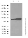 Anti-Angiotensin II Type 1 Receptor antibody [EPR3873]