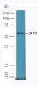 细胞角蛋白10抗体