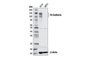Epithelial-Mesenchymal Transition (EMT) IF Antibody Sampler Kit
