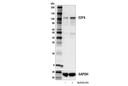 E2F8 (E8I3L) Rabbit mAb