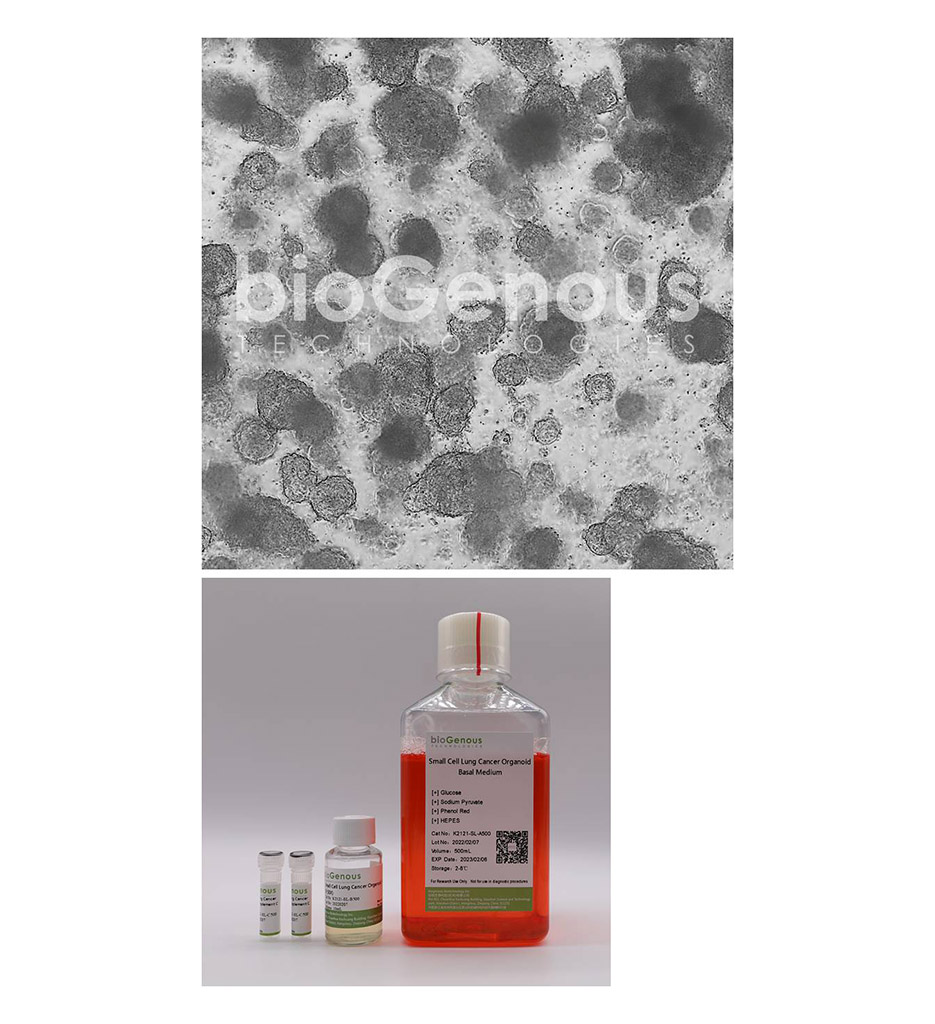 Small Cell Lung Cancer Organoid Kit小细胞肺癌