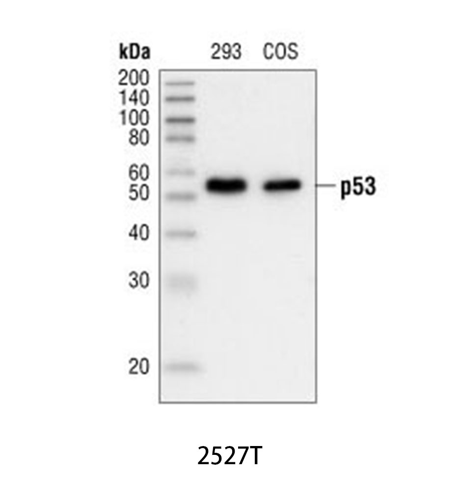 p53 (7F5) Rabbit mAb