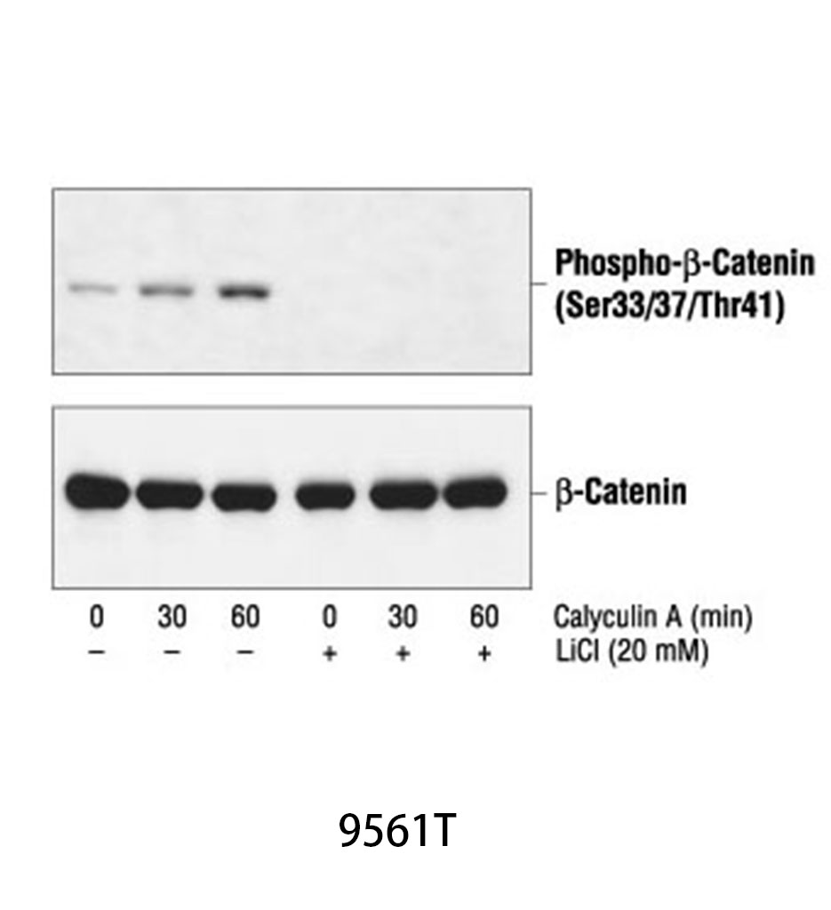 Phospho-β-Catenin (Ser33/37/Thr41) Antibody