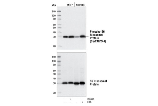 Phospho-S6 Ribosomal Protein (Ser240/244) (D68F8) XP Rabbit mAb