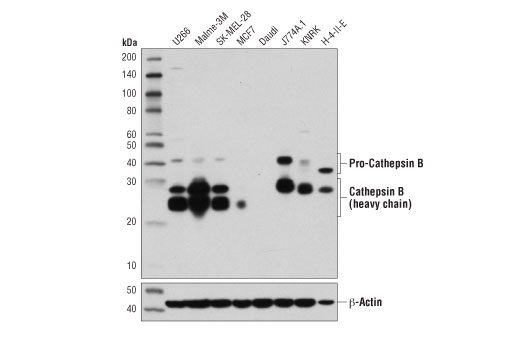 Cathepsin B (D1C7Y) XP Rabbit mAb