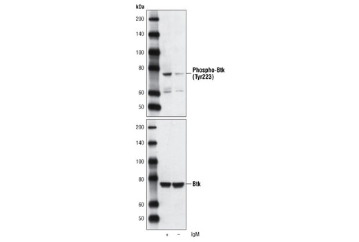Phospho-Btk (Tyr223) Antibody