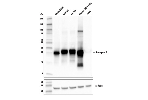 Granzyme B (D6E9W) Rabbit mAb
