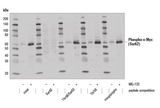 Phospho-c-Myc (Ser62) (E1J4K) Rabbit mAb
