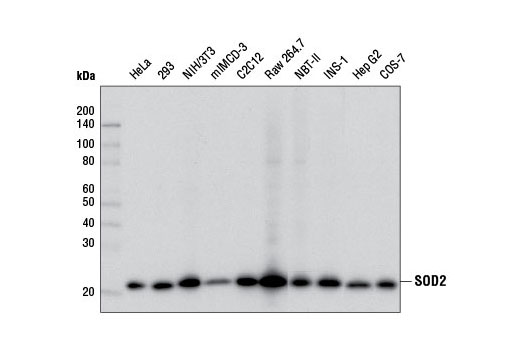SOD2 (D3X8F) XP Rabbit mAb