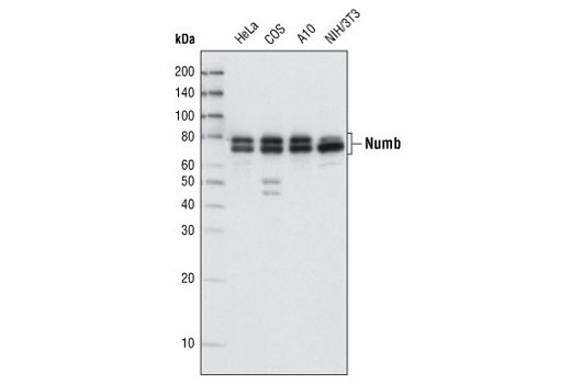 Numb (C29G11) Rabbit mAb