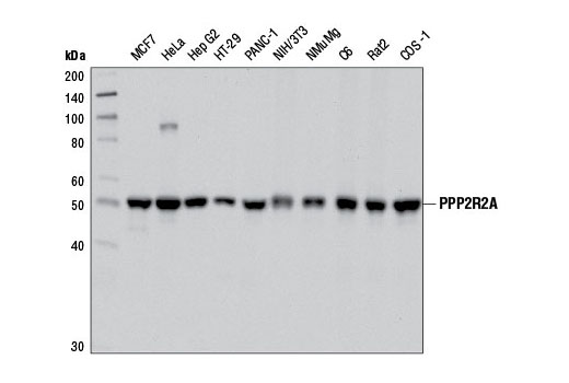 PPP2R2A (2G9) Mouse mAb