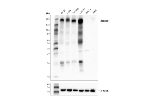 Jagged1 (D4Y1R) XP Rabbit mAb