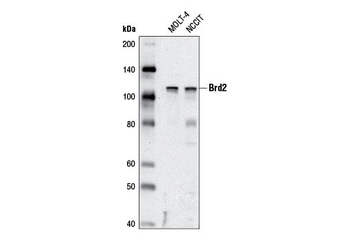 Brd2 (D89B4) Rabbit mAb