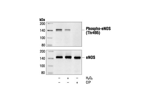 Phospho-eNOS (Thr495) Antibody