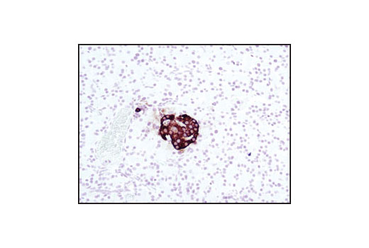 Insulin Antibody