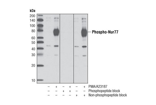 Phospho-Nur77 (Ser351) (D22G5) Rabbit mAb
