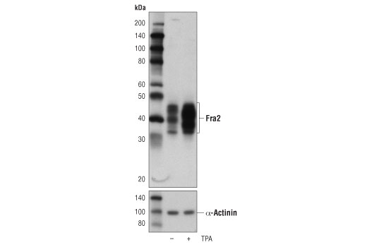 Fra2 (D2F1E) Rabbit mAb