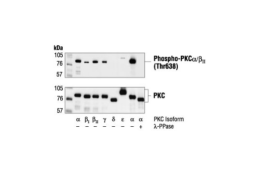 Phospho-PKCα/β II (Thr638/641) Antibody
