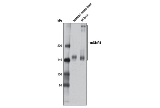 mGluR1 (D5H10) Rabbit mAb