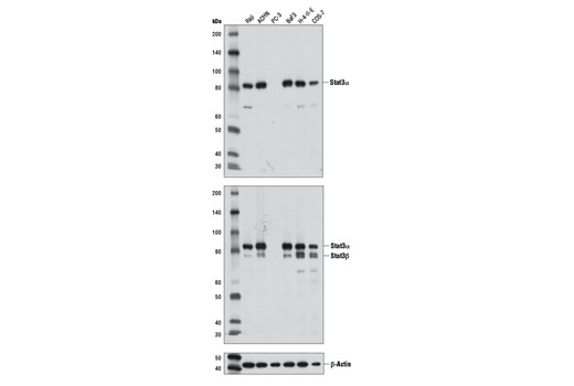 Stat3α (D1A5) XP Rabbit mAb