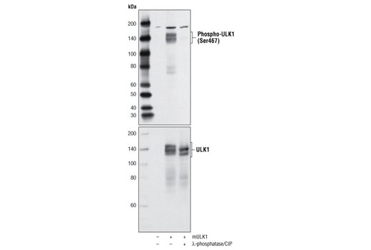 Phospho-ULK1 (Ser467) Antibody