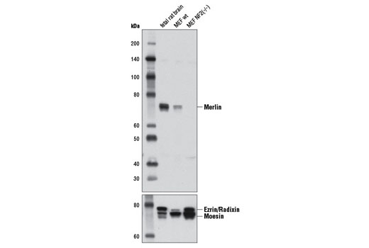 Merlin (D1D8) Rabbit mAb