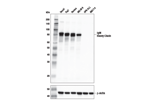 IgM Antibody