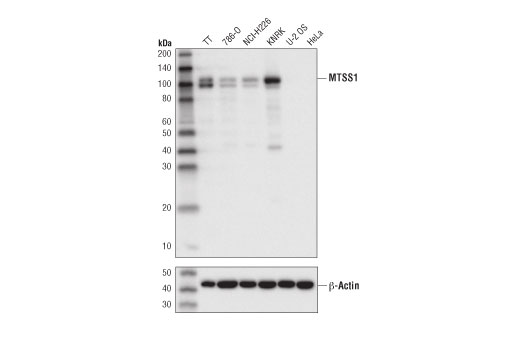 MTSS1 (D2H4L) XP Rabbit mAb