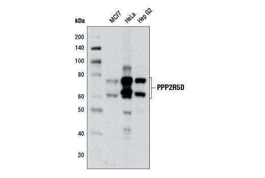 PPP2R5D (H5D12) Mouse mAb