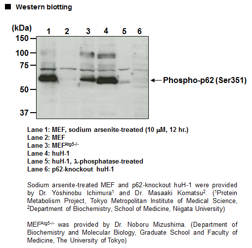 Anti-Phospho-p62 (SQSTM1) (Ser351) pAb