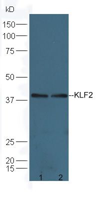 肺Kruppel样因子抗体