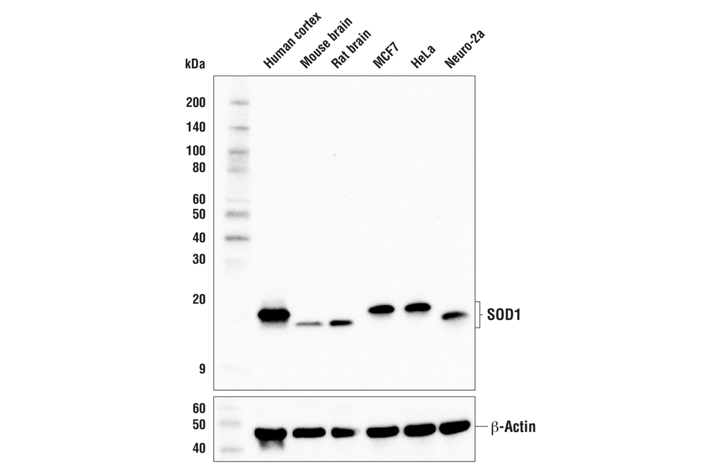 SOD1 (E4G1H) XPRabbit mAb