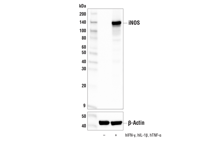 iNOS (E3W6B) Rabbit mAb
