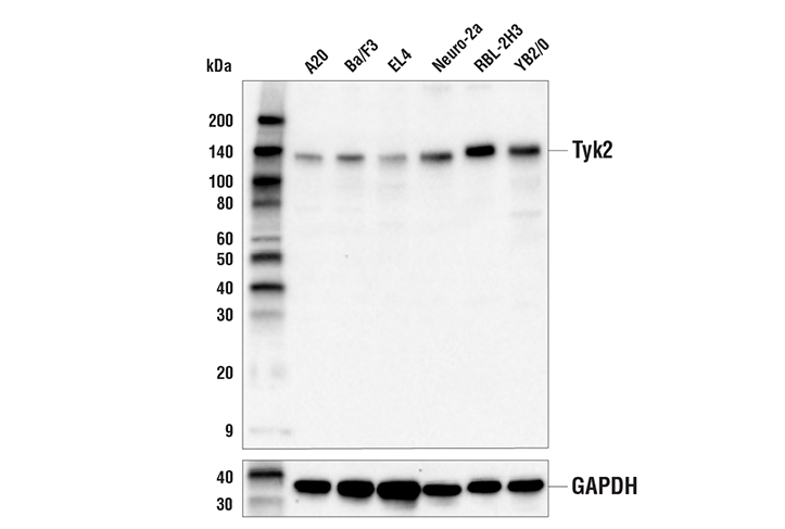 Tyk2 (E9H4T) Rabbit mAb