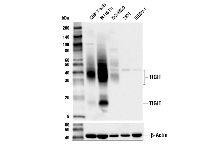 TIGIT (E5Y1W) XP Rabbit mAb
