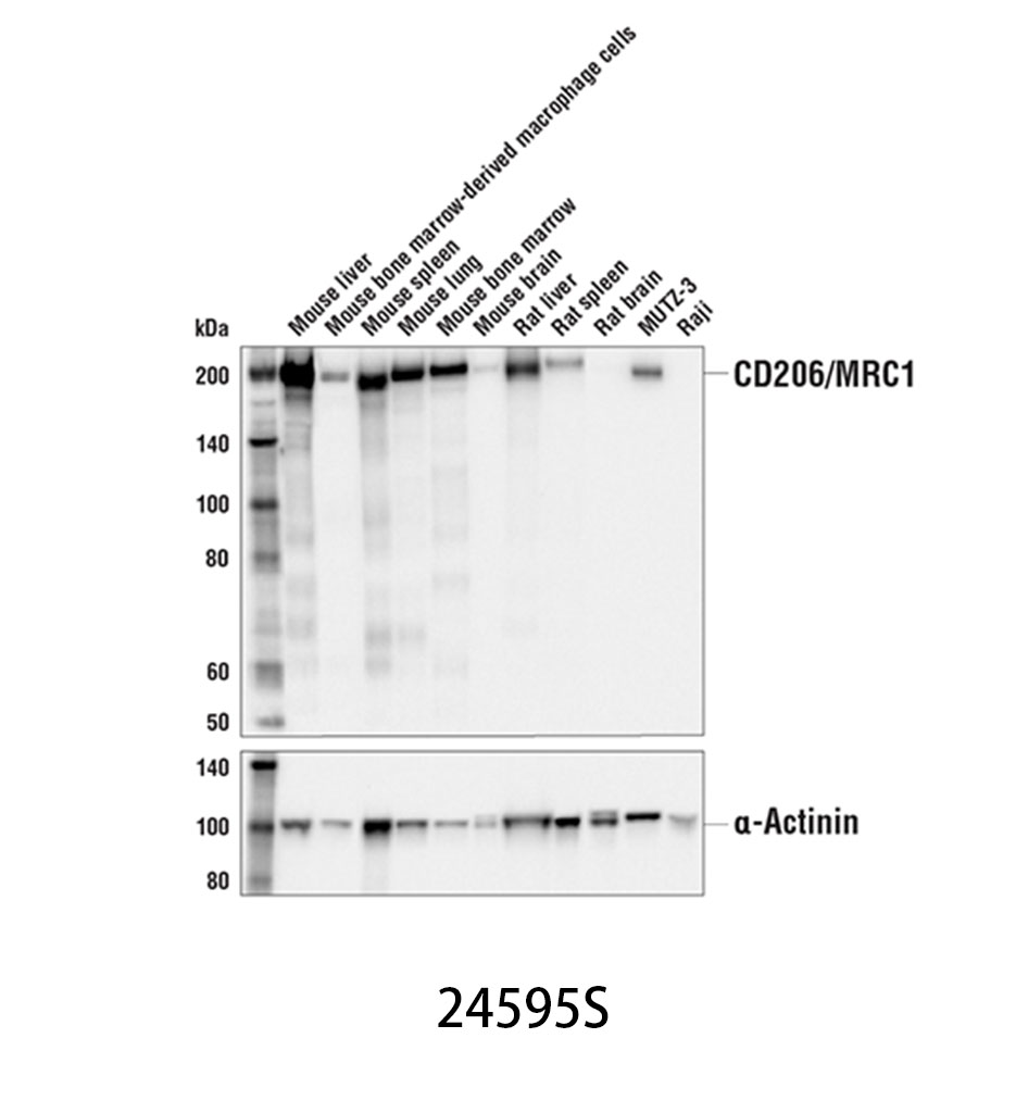 CD206/MRC1 (E6T5J) XP Rabbit mAb